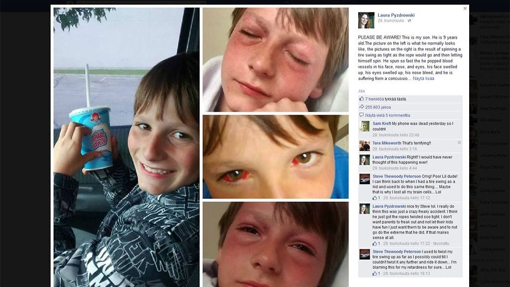 Varoittavat kuvat leviävät somessa. Kuvakaappaus Facebookista.