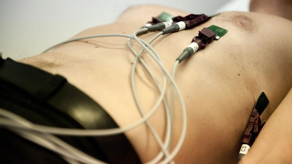 Rytmihäiriöitä tutkitaan sydänsähkökäyrällä eli EKG:llä.
