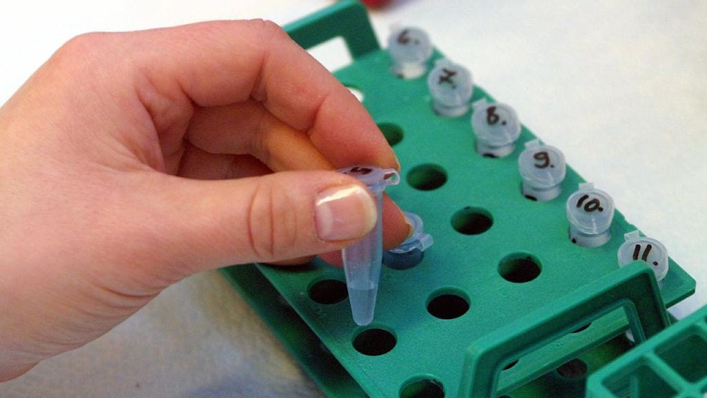 Kuvituskuva hiv-lääkityksen seurantatestin valmistelusta.