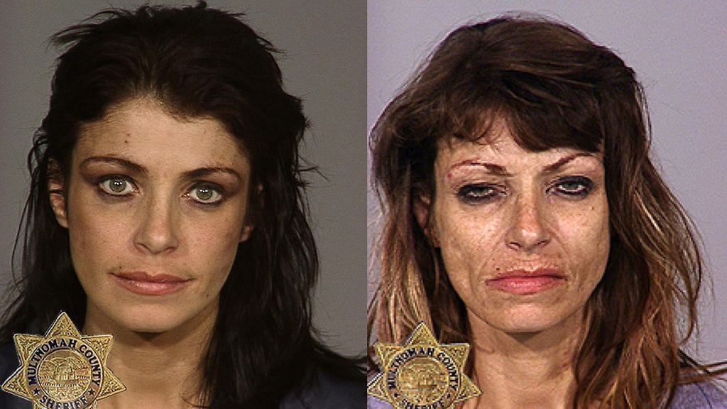 Metamfetamiinin käyttö jättää jälkensä myös ulkoisesti. Vasemmalla vuonna 2001 otettu kuva ja oikealla 2008. Kuvat ovat osa yhdysvaltalaista valistuskampanjaa.