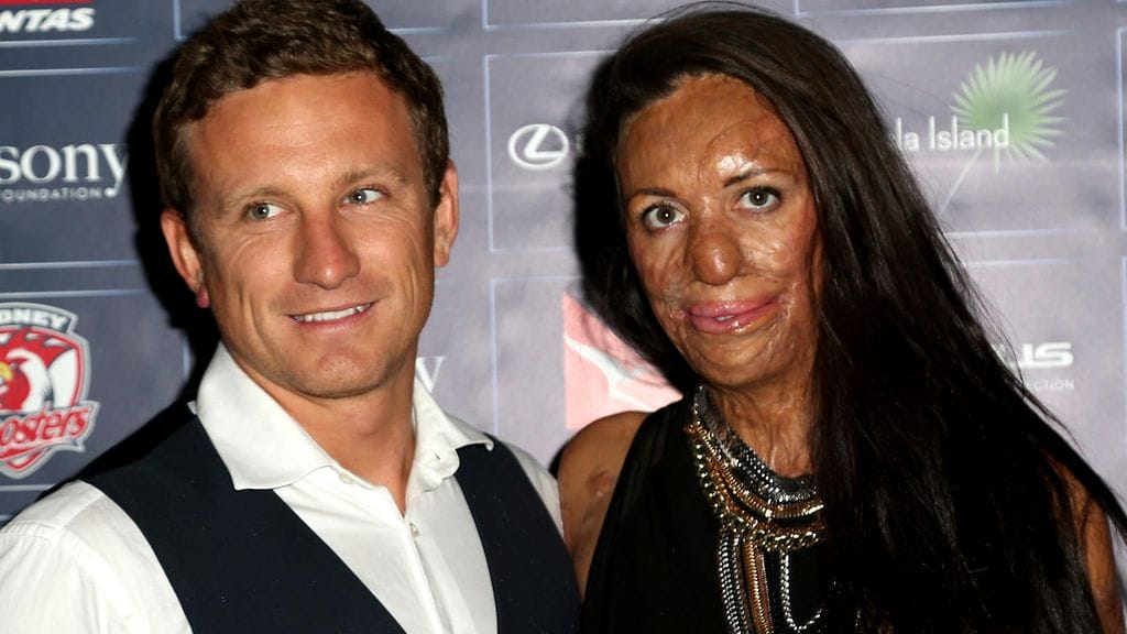 Turia Pitt joutui vakavaan onnettomuuteen neljä vuotta sitten.