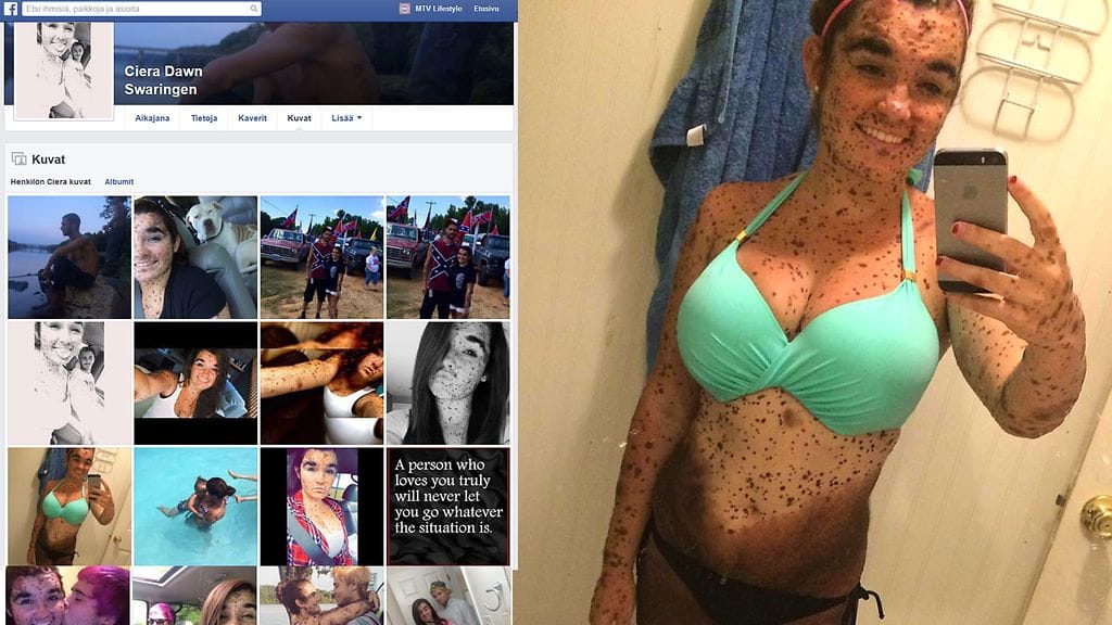 Ciera Swaringen on oppinut olemaan ylpeä syntymämerkeistään. Kuvakkaappaus: Facebook