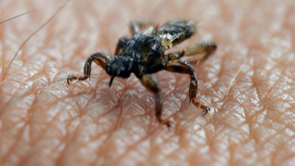 Nappaa ilmastointiteippi mukaan metsäretkelle ja hirvikärpäset kiusaavat vähemmän.