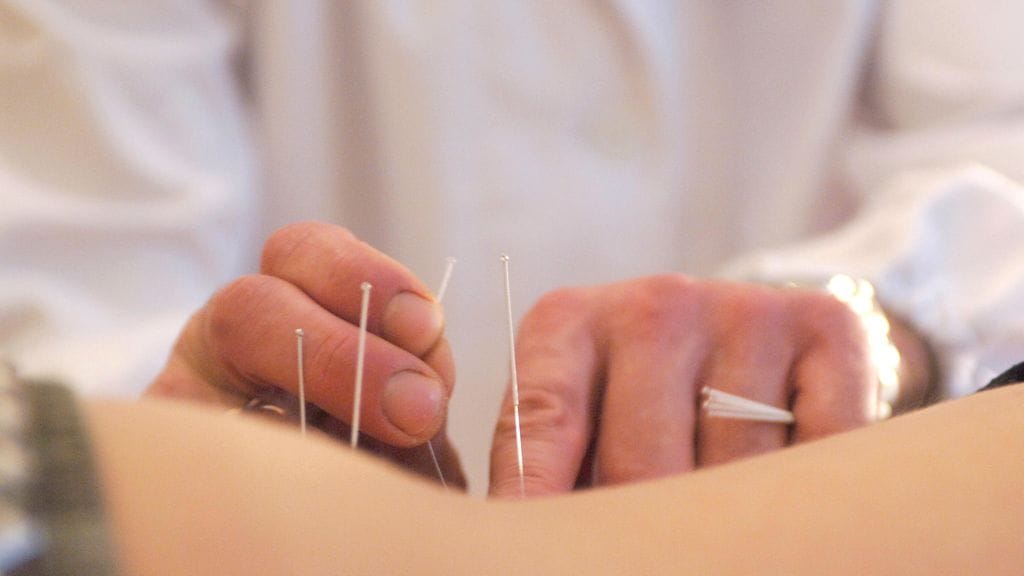Akupunktiolla ei pidä korvata esimerkiksi kasvaimiin tai tulehduksiin käytettäviä, oikeasti tehoavia hoitoja. Kuvituskuva.