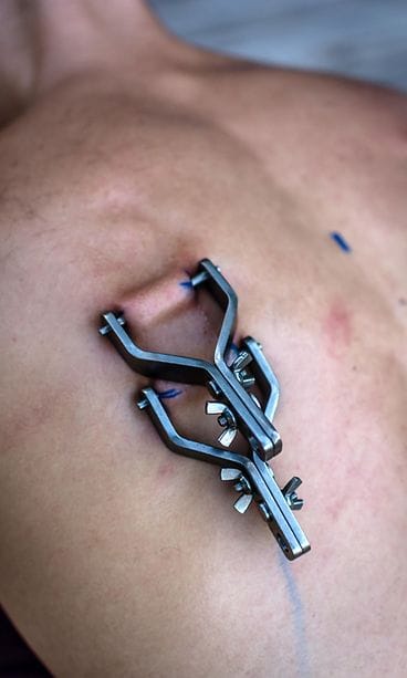 Suspensio-basehyppy (2)