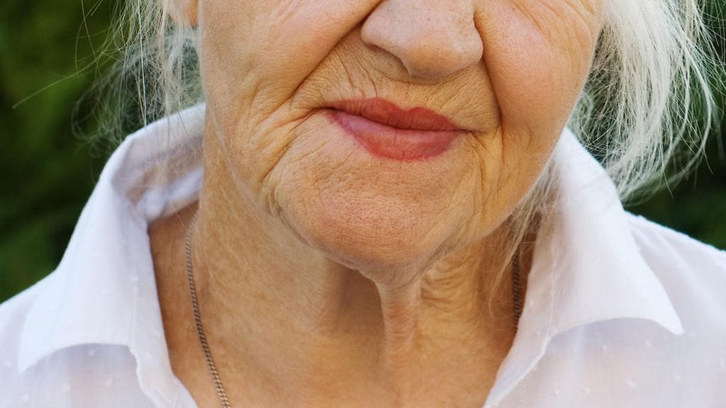 Muista levittää aurinkorasvaa myös kaulalle.