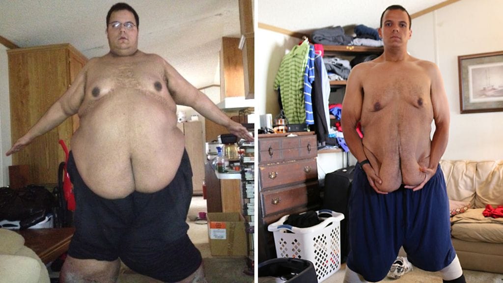 Entinen kiusaaja laihdutti yli 180 kiloa.