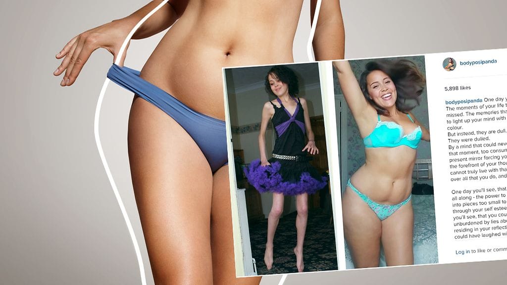 Nykyään entinen anorektikko julistaa oman vartalon rakastamista.