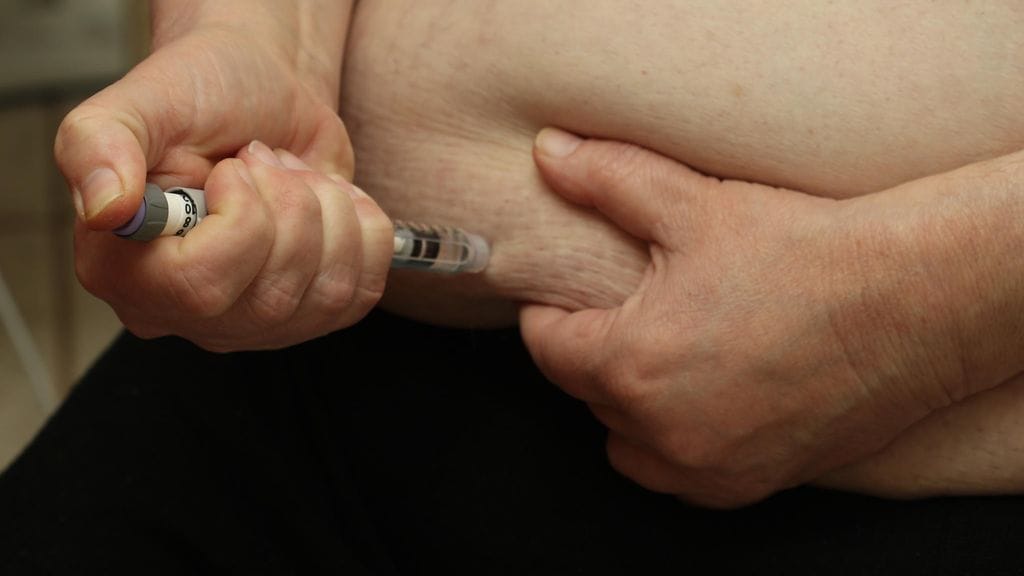 "Pieni osa tyypin I diabeetikoista muistuttaa taudinkuvaltaan aluksi tyyppiä II", lääkäri kirjoittaa.