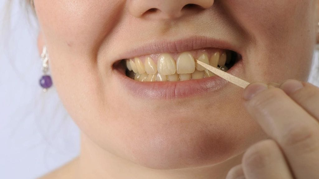 Huono suuhygienia voi aiheuttaa metallista makua suussa.