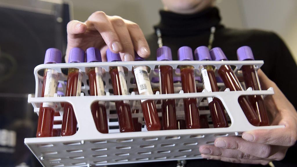 Suomessa yleisin veriryhmä A+ on 38 prosentilla väestöstä ja harvinaisin AB– vain yhdellä prosentilla.