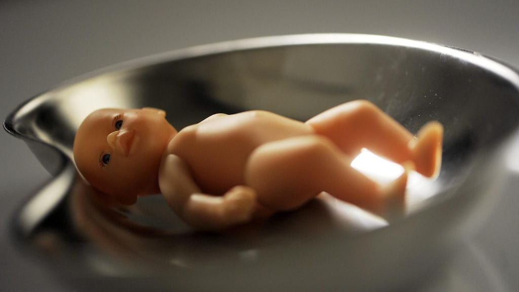 Tuore amerikkalaistutkimus tutki, miten abortti vaikuttaa naisen mielenterveyteen tulevina vuosina.