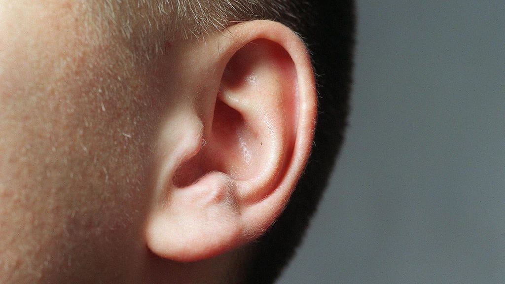 Keskivaikeassa kuulonalenemassa henkilö ei kuule hiljaisia tai kohtalaisen kovia ääniä. Taustahälyssä puheen ymmärtäminen on vaikeaa.