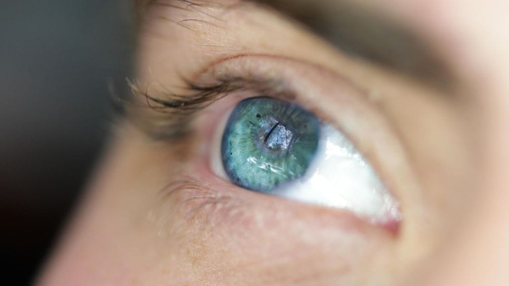 Limakalvojen kuivumisoireet ovat Sjögrenin syndroomassa tyypillisiä.