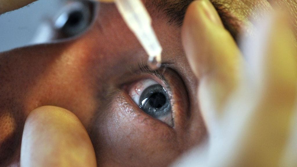 Sjögrenin syndrooma voidaan diagnosoida erilaisia testejä apuna käyttäen.