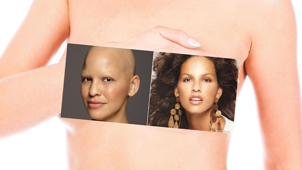 Yli kaksikymmentä vuotta mallina toiminut Mieko Rye julkaisi kuvan itsestään hiuksettomana insiroidakseeen muita naisia.