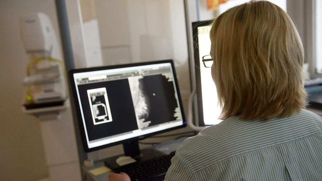 Lehden artikkelin mukaan naispotilas kävi läpi 22 sädehoitokertaa, joilla yritettiin hoitaa hänen rintasyöpäänsä. Kuvituskuva.