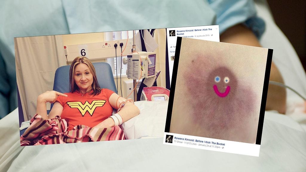 Rintasyöpäpotilaan nännikuva poistettiin alastomuuteen vedoton. Lopulta sivusto myönsi tehneensä virheen.