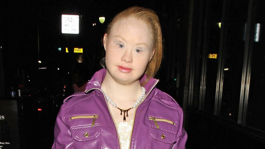 Unelmat voivat toteutua. Madeline Stuart toimii tätä nykyä mallina.