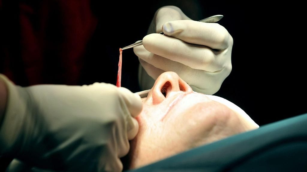 Silmäluomileikkaus on yleisimpiä ikääntyvien plastiikkakirurgian asiakkaiden toiveita.