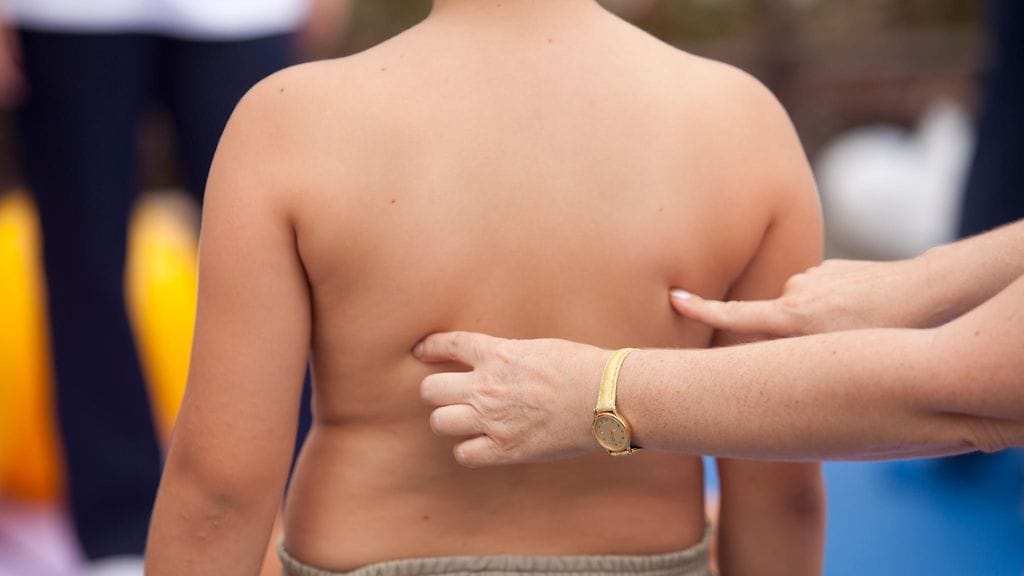 Ylipainoisuus on maaseudun lapsilla yleisempää kuin taajamissa. Kuvituskuva.