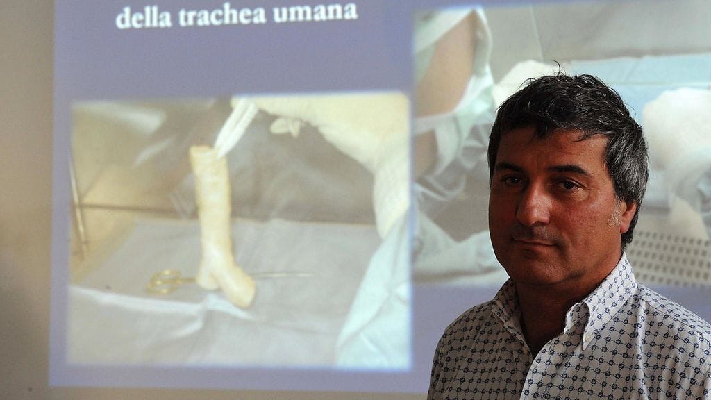 Elinsiirtokirurgi Paolo Macchiarini piti lehdistötilaisuuden onnistuneiden henkitorvisiirtojen jälkeen Firenzessä Italiassa vuonna 2010.