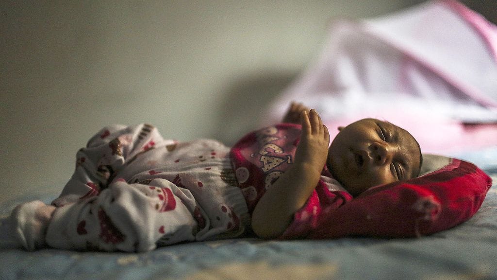 Brasilialaislapsella todettiin heti syntyessään mikrokefalia-oireyhtymä. Sen uskotaan johtuvan äidin saamasta zika-virukseseta.