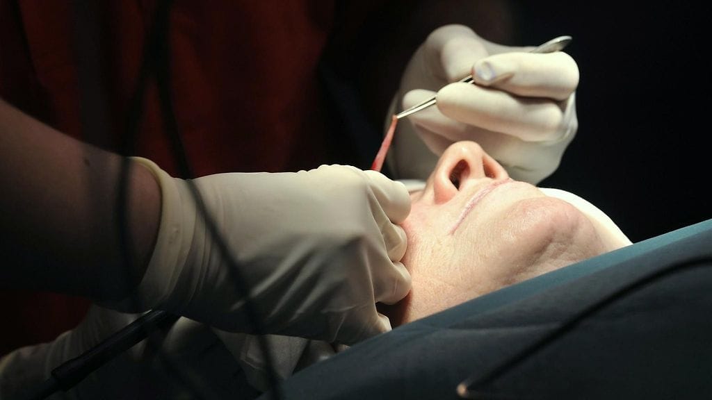 Silmäluomia leikataan paitsi kosmeettisista, myös terveydellisistä syistä. Kuvituskuva.