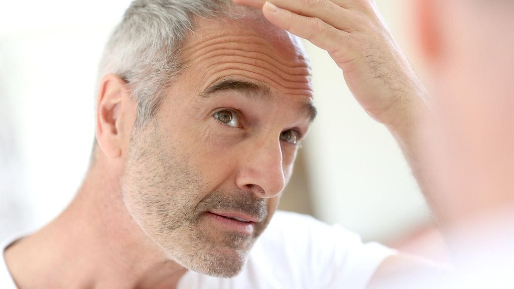 Geenit vaikuttavat niin hiusten harmaantumiseen kuin parran tuuheuteenkin.