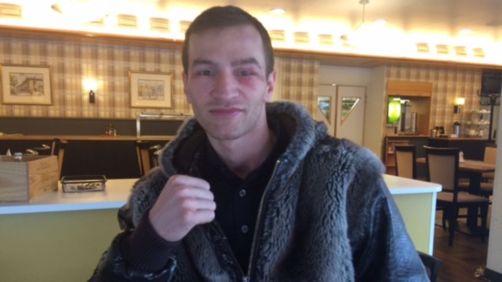 Edis Tatli naama mustelmilla