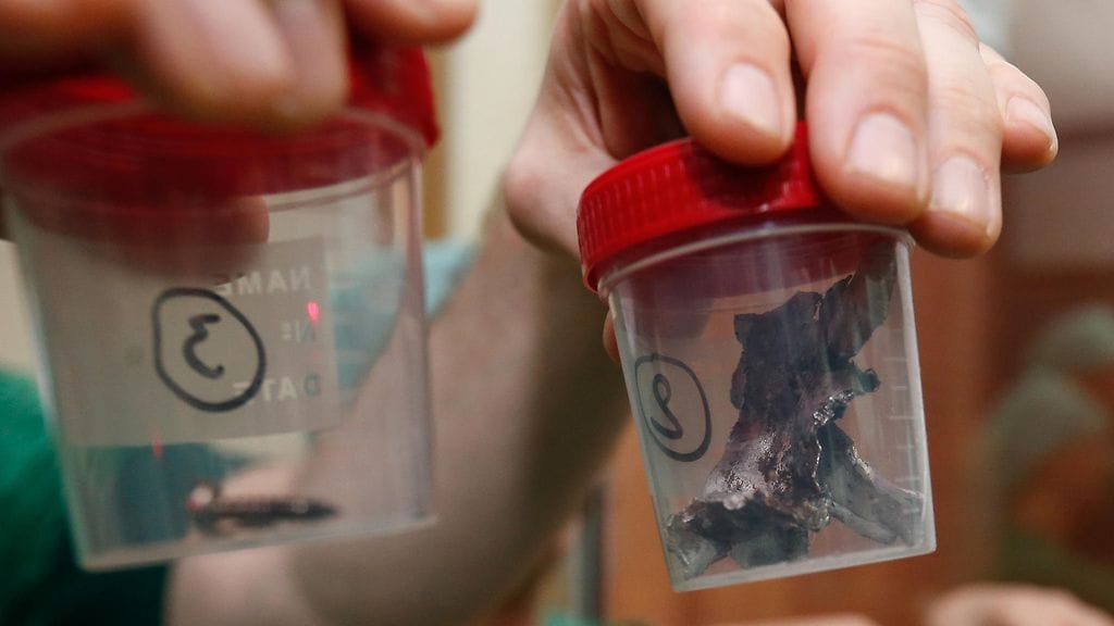 Iskuissa loukkaantuneista ihmisistä on jouduttu poistamaan useiden senttien mittaisia metallinpaloja.