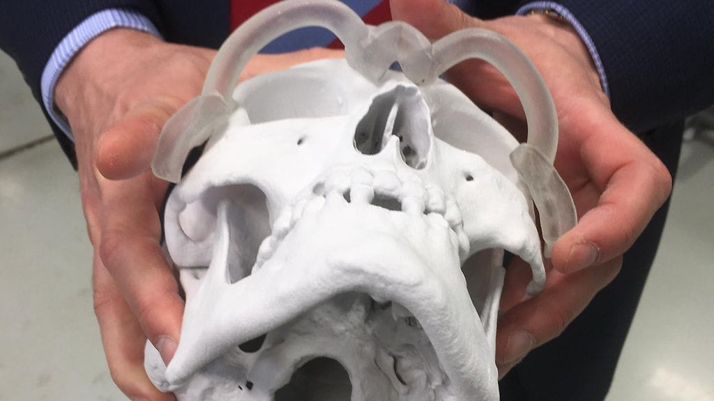 3D-tekniikalla totetutettu pääkallo.