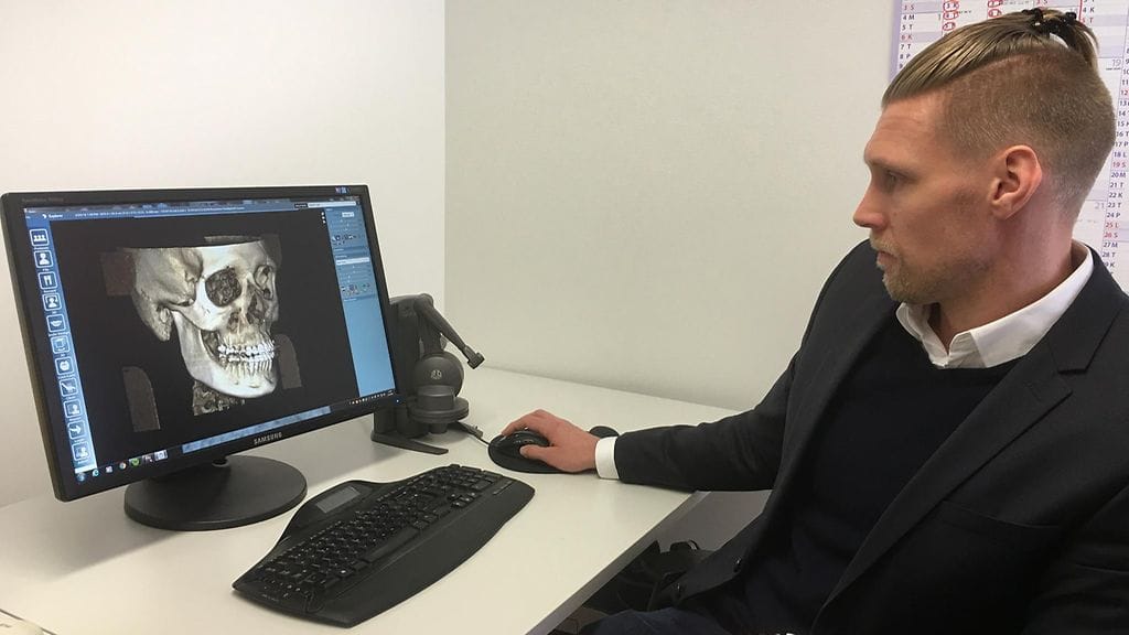 3D-tekniikka, kallo, terveysteknologia, Planmeca, kasvojensiirto