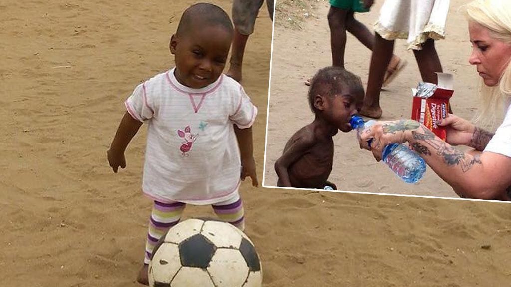 Anja Riggren Loven on julkaissut Facebook-sivuillaan uusia kuvia Hopesta. Niissä näkyvää lasta ei uskoisi samaksi, sillä kuvissa leikkii iloinen, normaalipainoinen 2-vuotias.