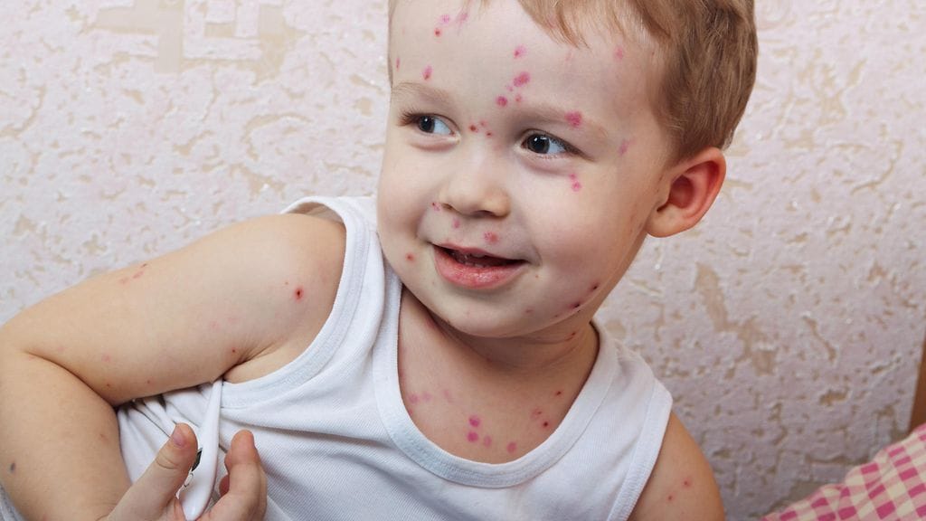 Pieni poika oli menehtyä tulehduskipulääkkeen vuoksi.