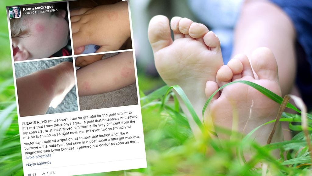 Heinikossa liikkuessa kannattaa varautua punkkienpuremien varalle.