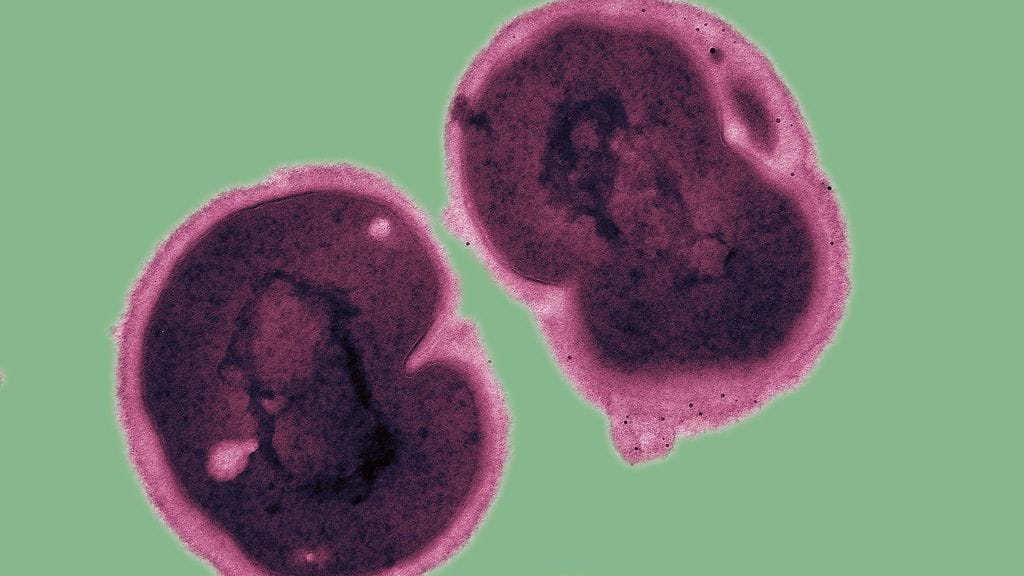 Neisseria gonorrhoea, tippuribakteeri