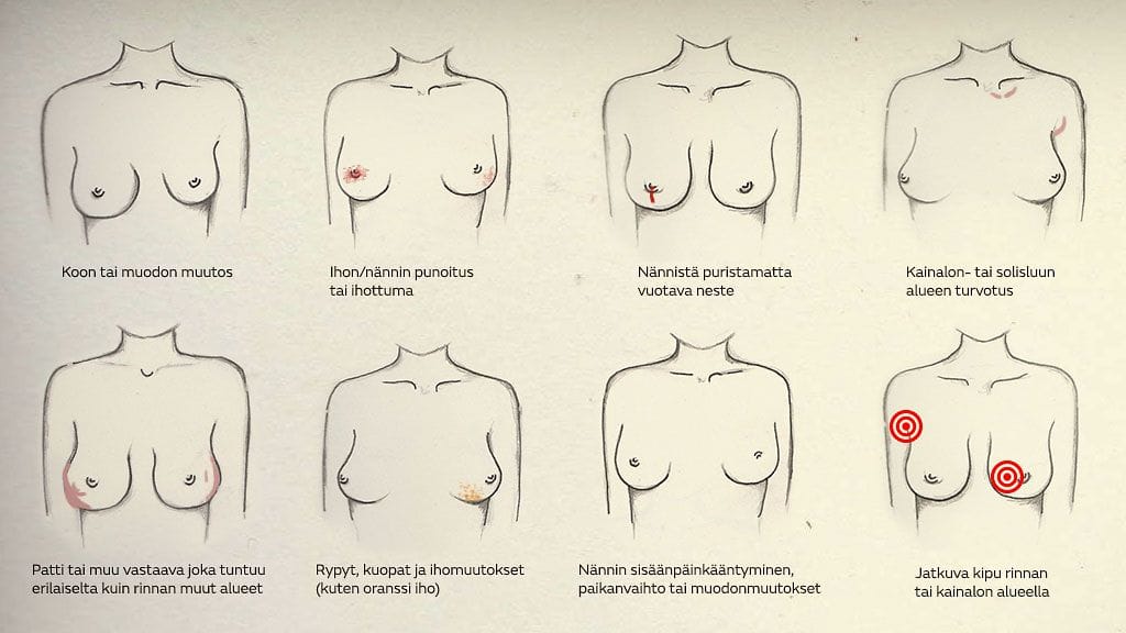Rintoja kannattaa tarkkailla muutosten varalta säännöllisesti.
