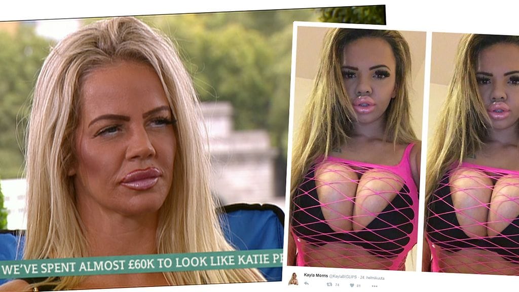 Äiti ja tytär tekevät kaiken yhdessä aina kauneusleikkauksia myöten.