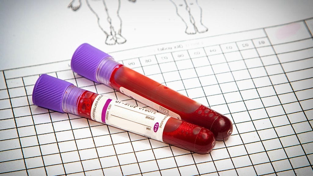 Veri kertoo sinusta yllättävän paljon.