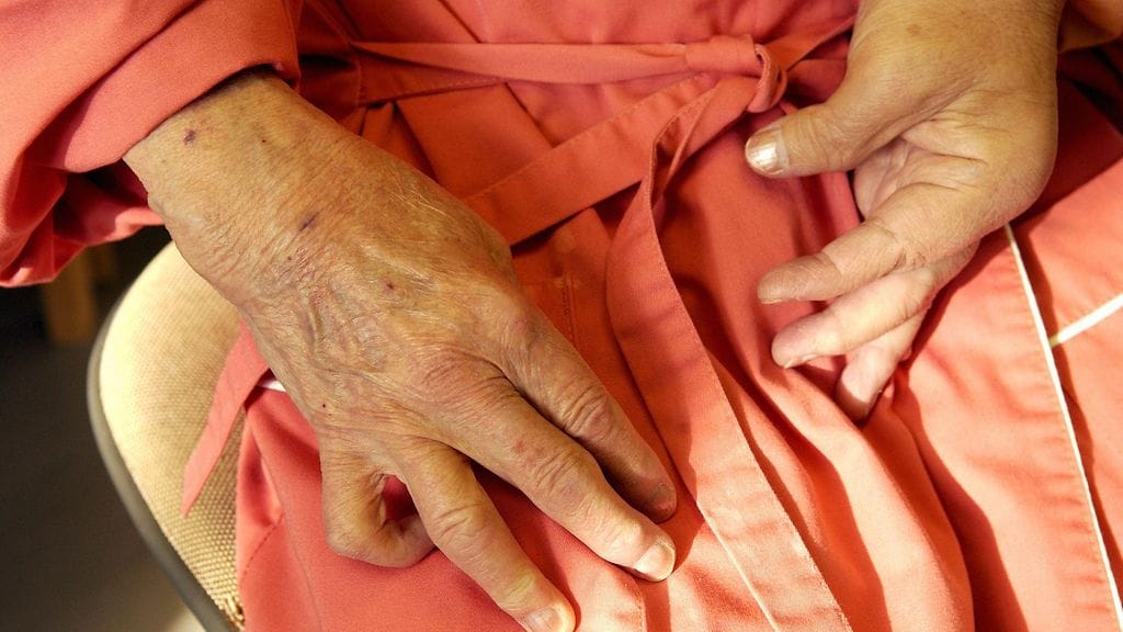 Kuolleisuus ja sydänoireet selittyvät pitkälti sydän- ja verisuonitautien riskitekijöillä sekä kroonisella tulehdustilalla, joka liittyy reumaattisiin sairauksiin. Kuvituskuva.