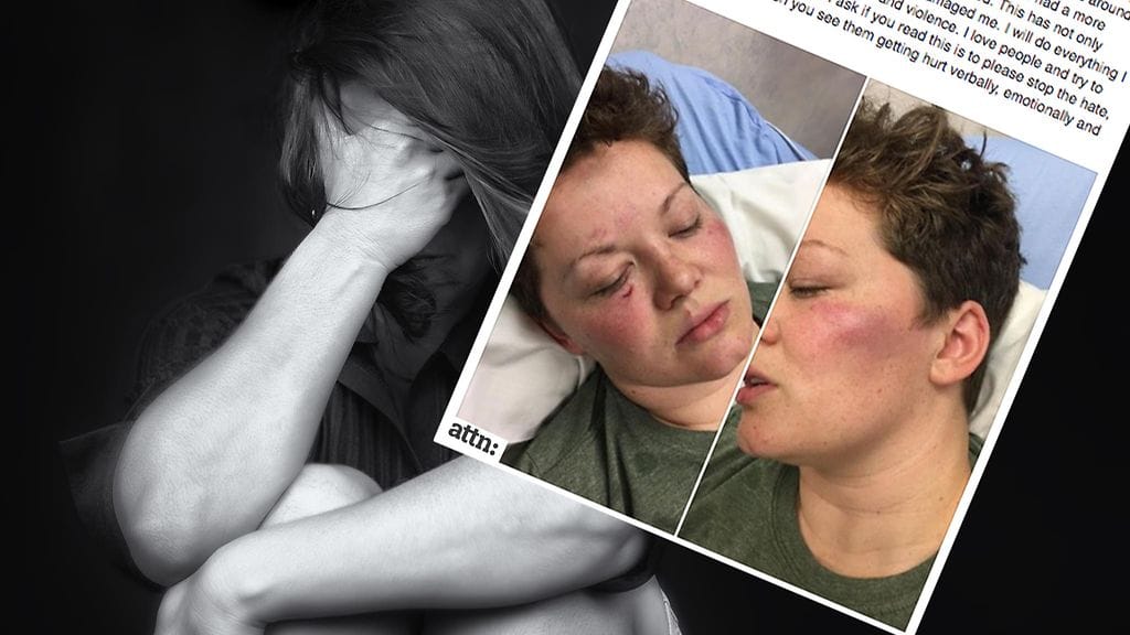 Nainen hakattiin, koska hänen ulkonäkönsä "ei miellyttänyt"