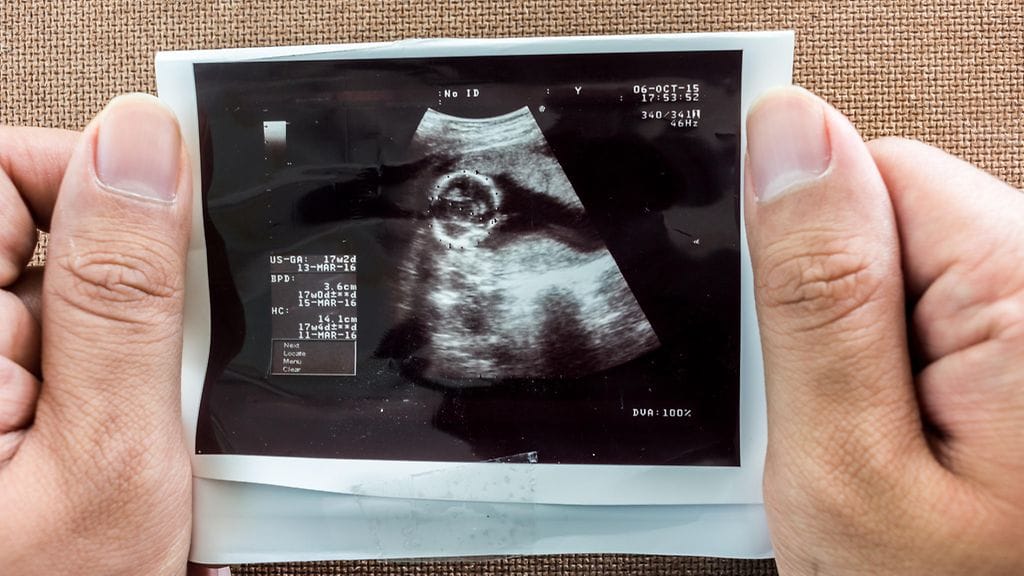 Tämän pariskunnan raskaus vaati neljän vuoden yrittämisen. He tietävät, että kaikissa tapauksessa loppu ei ole ollut yhtä onnellinen.