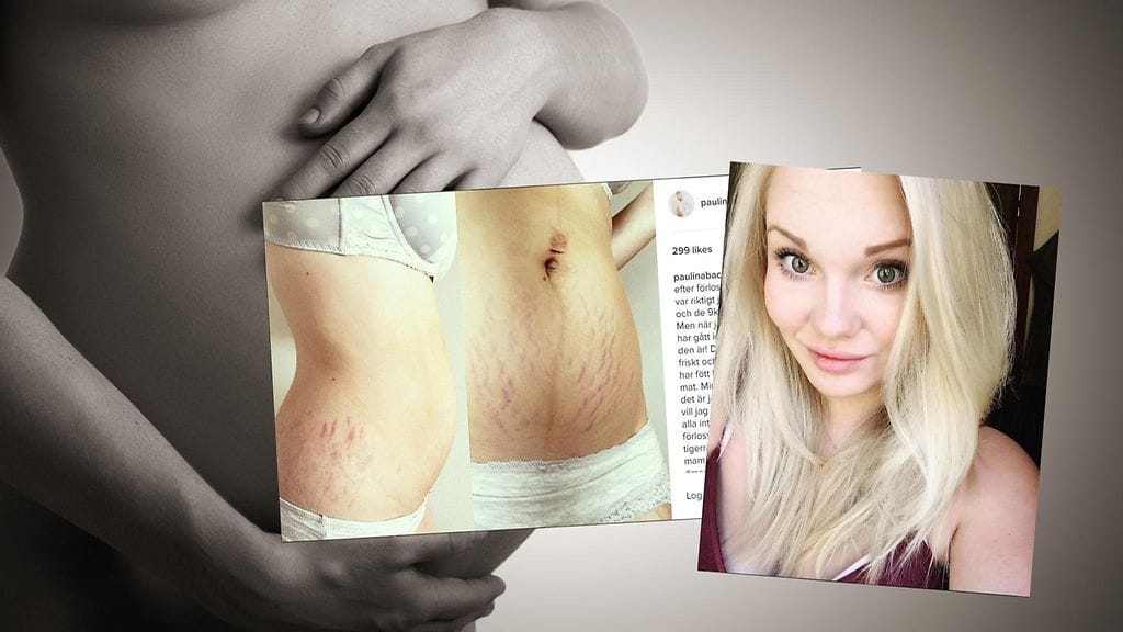 Nuoren ruotsalaisäidin mukaan lapsi tulisi mennä omasta ulkonäöstä huolehtimisen edelle.