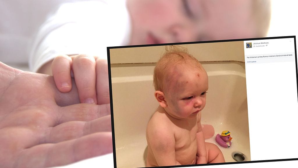 Tämä hurja kuva ei riittänyt saattamaan lastenhoitajaa vastuuseen.