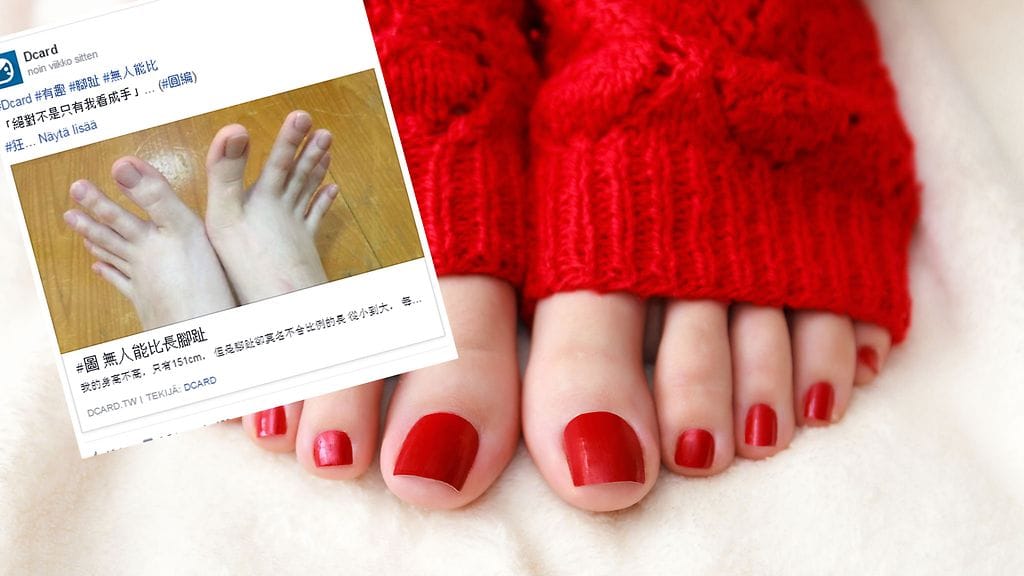 Taiwanilaisnaisen varpaat menisivät sormista.