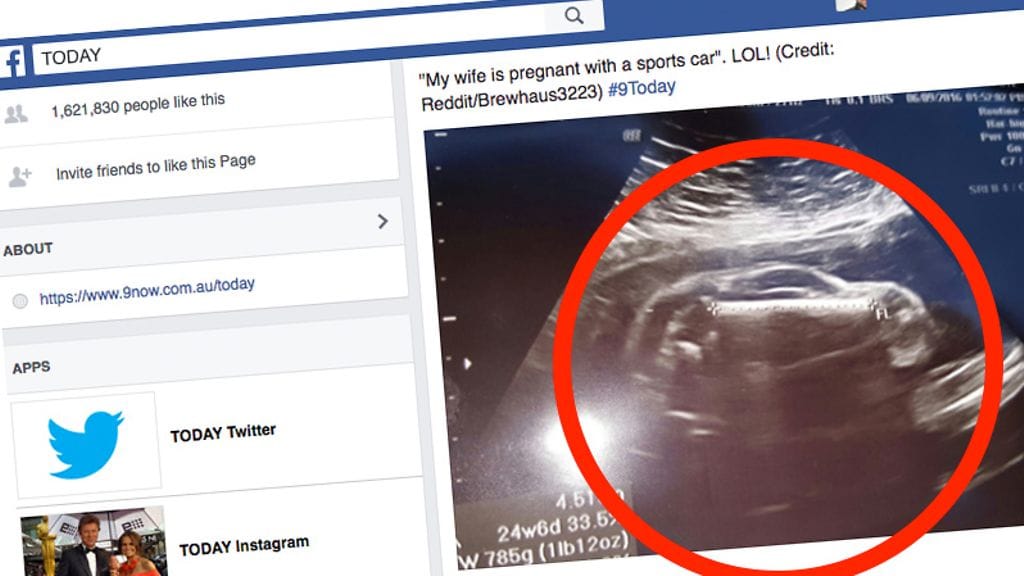Australialaisen Today-aamushow'n Facebook-sivuille julkaistu Reddit-kuva ultraääniotoksesta.