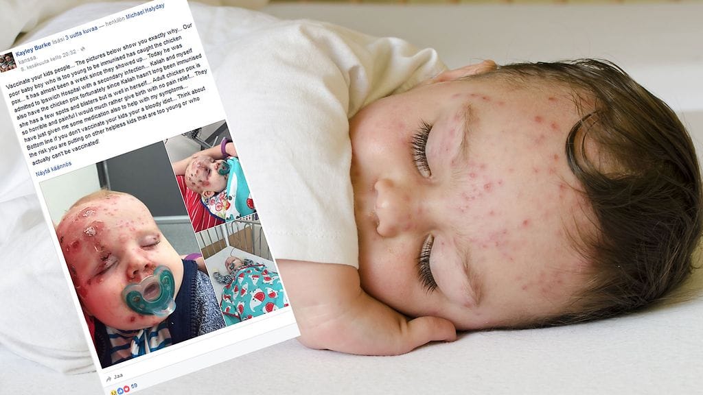 Australialaisäiti kehottaa kaikkia rokottamaan lapsensa.