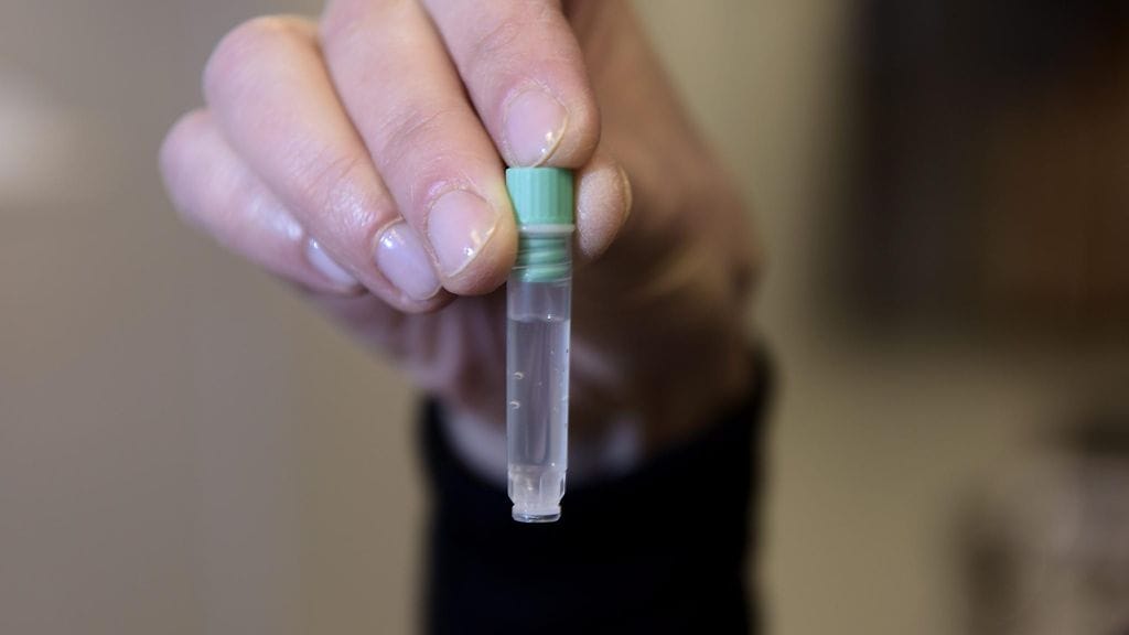 Arkistokuva. DNA-näyte biopankin tiloissa Biomedicumissa, Helsingissä 5. helmikuuta 2015.