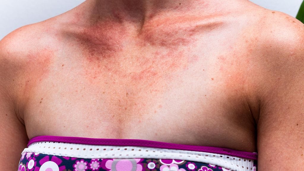 Herkkäihoisen täytyy käytössä kokeilla, mikä tuote hänelle sopii.